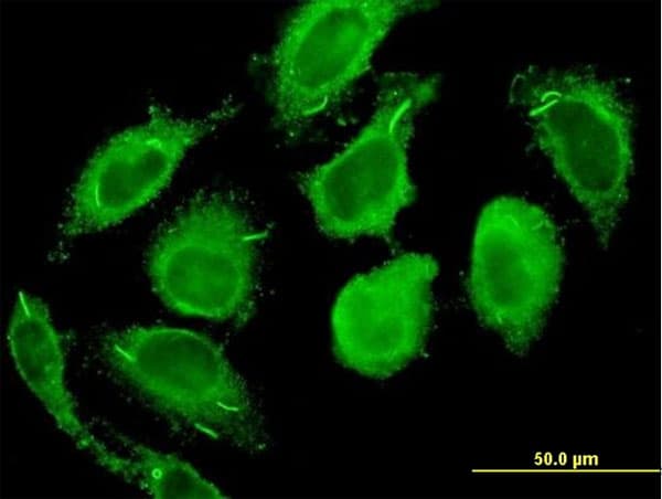CALM2 / Calmodulin 2 Antibody (clone 3F4-G5)