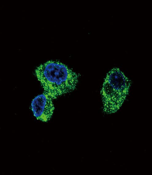 PIGR Antibody (aa646-672)