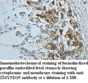 ZMYND19 Antibody (aa1-227)