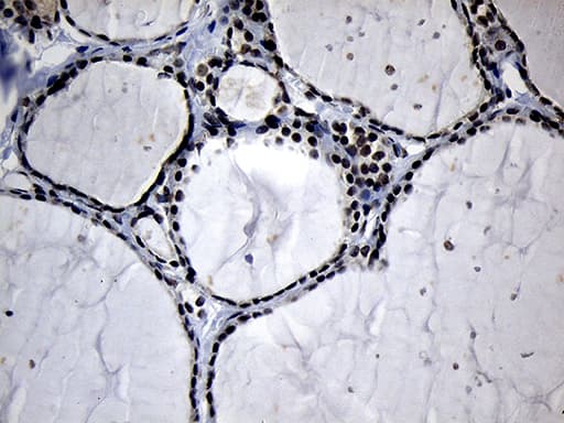 ELL / MEN Antibody (aa302-621, clone OTI3A8)