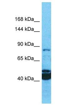 MROH1 / HEATR7A Antibody (aa62-111)