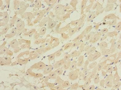 Polyclonal Rabbit anti-Human ZBTB6 Antibody (IHC, WB)