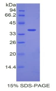 Mouse ANGPTL7 / CDT6 Protein (Recombinant His)