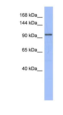 Polyclonal Rabbit anti-Human MSH4 Antibody (aa107-156, WB)