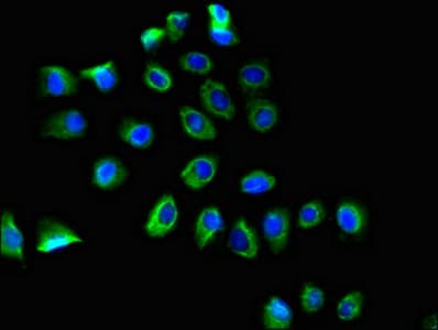 PTGER3 / EP3 Antibody