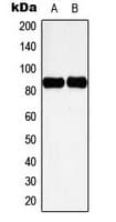 Polyclonal Rabbit anti-Human CTTN / Cortactin Antibody (phospho-Tyr466, IHC, IF, WB)