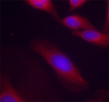RELA / NFKB p65 Antibody (phospho-Ser536)