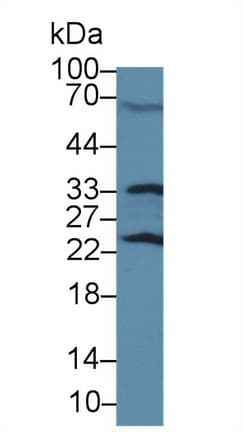 GSTP1 / GST Pi Antibody (aa1-210, PE)