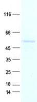 Human AK8 Protein (Recombinant His, N-Terminal)