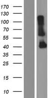 CYHR1 Protein (Over-Expression Lysate Myc-DDK (Flag))
