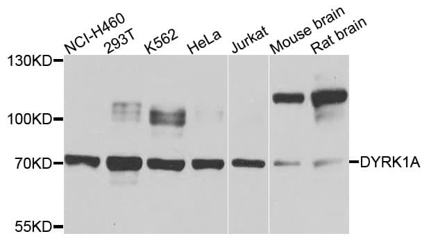 Polyclonal Rabbit anti-Human DYRK / DYRK1A Antibody (WB)