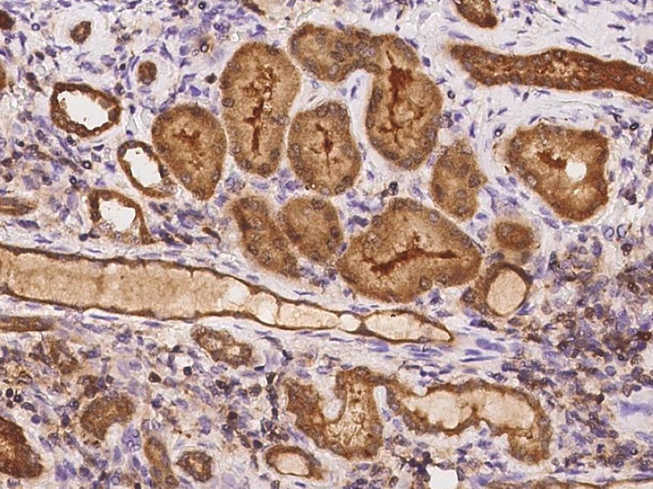 TSTD1 Antibody