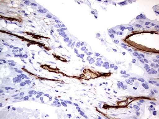MCAM / CD146 Antibody (clone UMAB154)