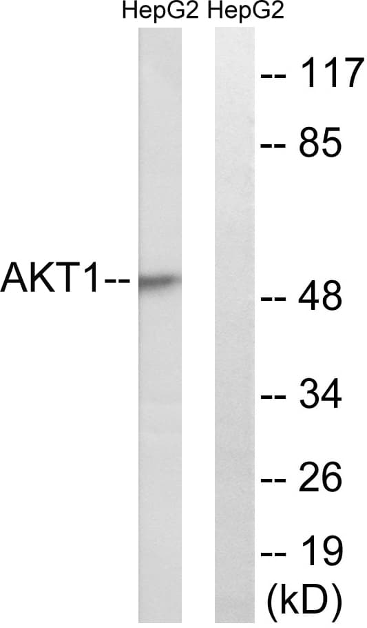 IHC-plus™ Polyclonal Rabbit anti-Human AKT1 Antibody (aa95-144, IHC, IF, WB)
