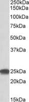 IHC-plus™ PSMB4 Antibody (aa233-243)