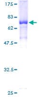 Human KDM8 / JMJD5 / FLJ13798 Protein (Recombinant GST)