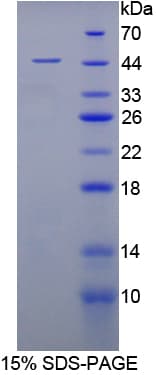 Rabbit ENO3 / Enolase 3 Protein (Recombinant His)