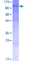 Human WAC Protein (Recombinant GST)