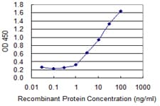 Monoclonal Mouse anti-Human ACAA1 Antibody (clone 3F11, IHC, WB)