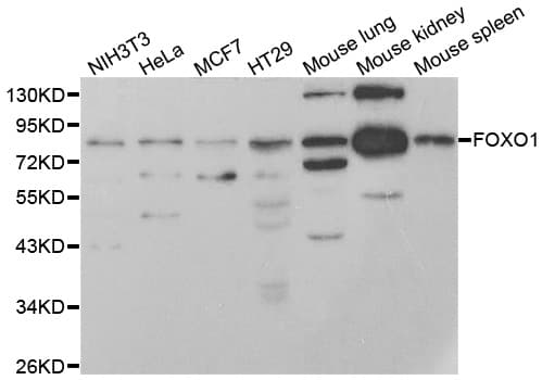 Polyclonal Rabbit anti-Human FOXO1 / FKHR Antibody (IF, WB)