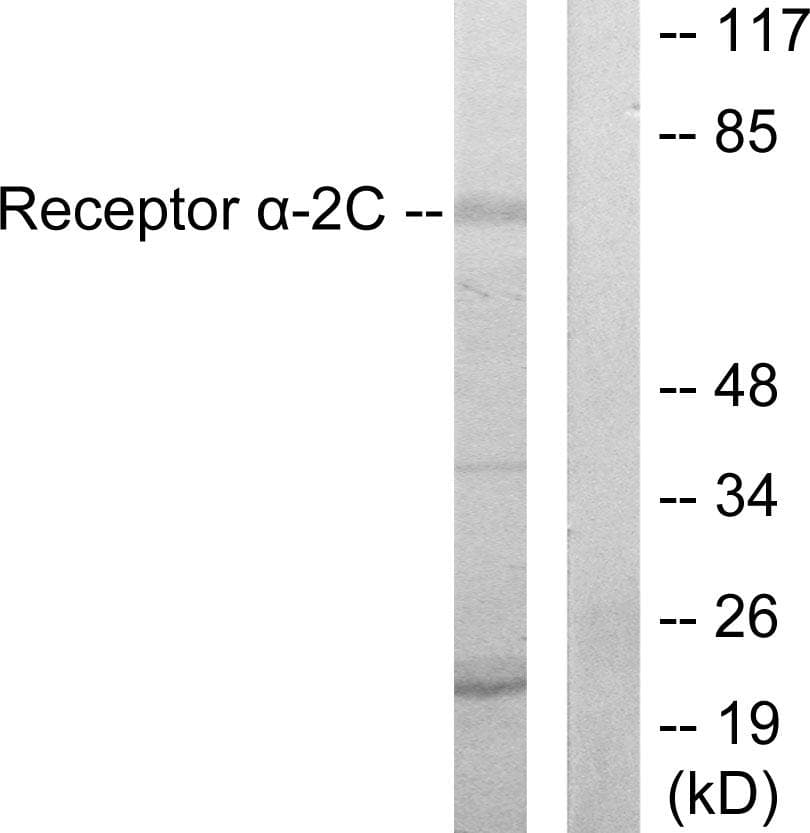 ADRA2C Antibody