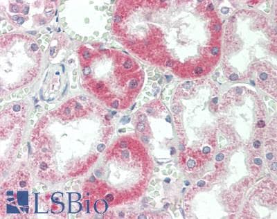 IHC-plus™ PTHLH / PTHRP Antibody (aa25-175)