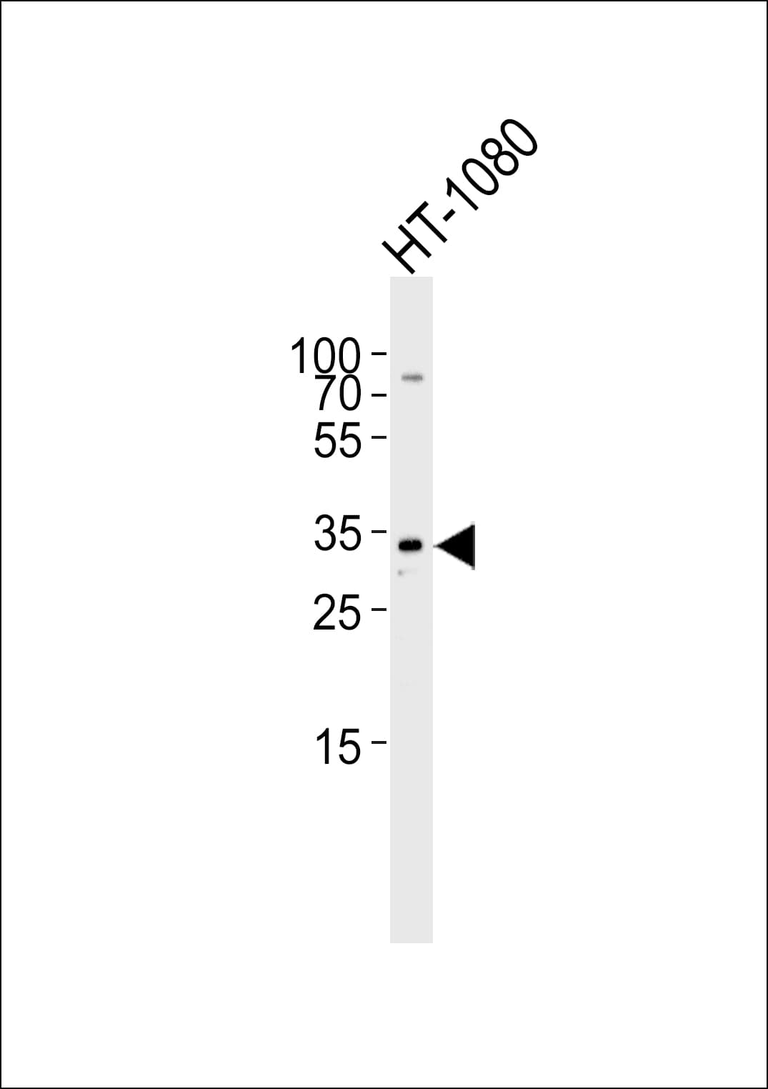 ARPC2 / p34-Arc Antibody (aa278-311)