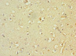TACR3 / NK3R Antibody (aa356-465)