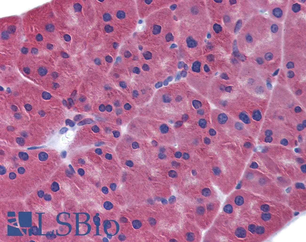 IHC-plus™ IFIH1 / MDA5 Antibody