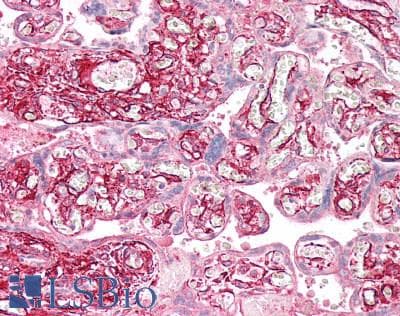 IHC-plus™ TPM4 Antibody (aa266-276)