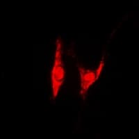 PSMD8 / RPN12 Antibody