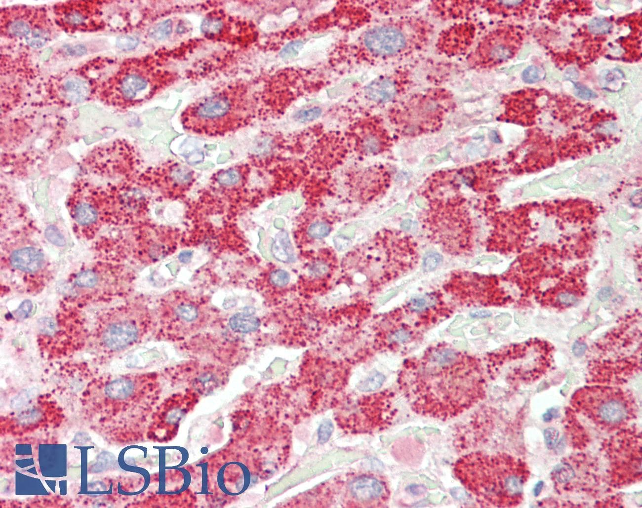 IHC-plus™ Polyclonal Goat anti-Human HADH Antibody (aa234-245, IHC, WB)