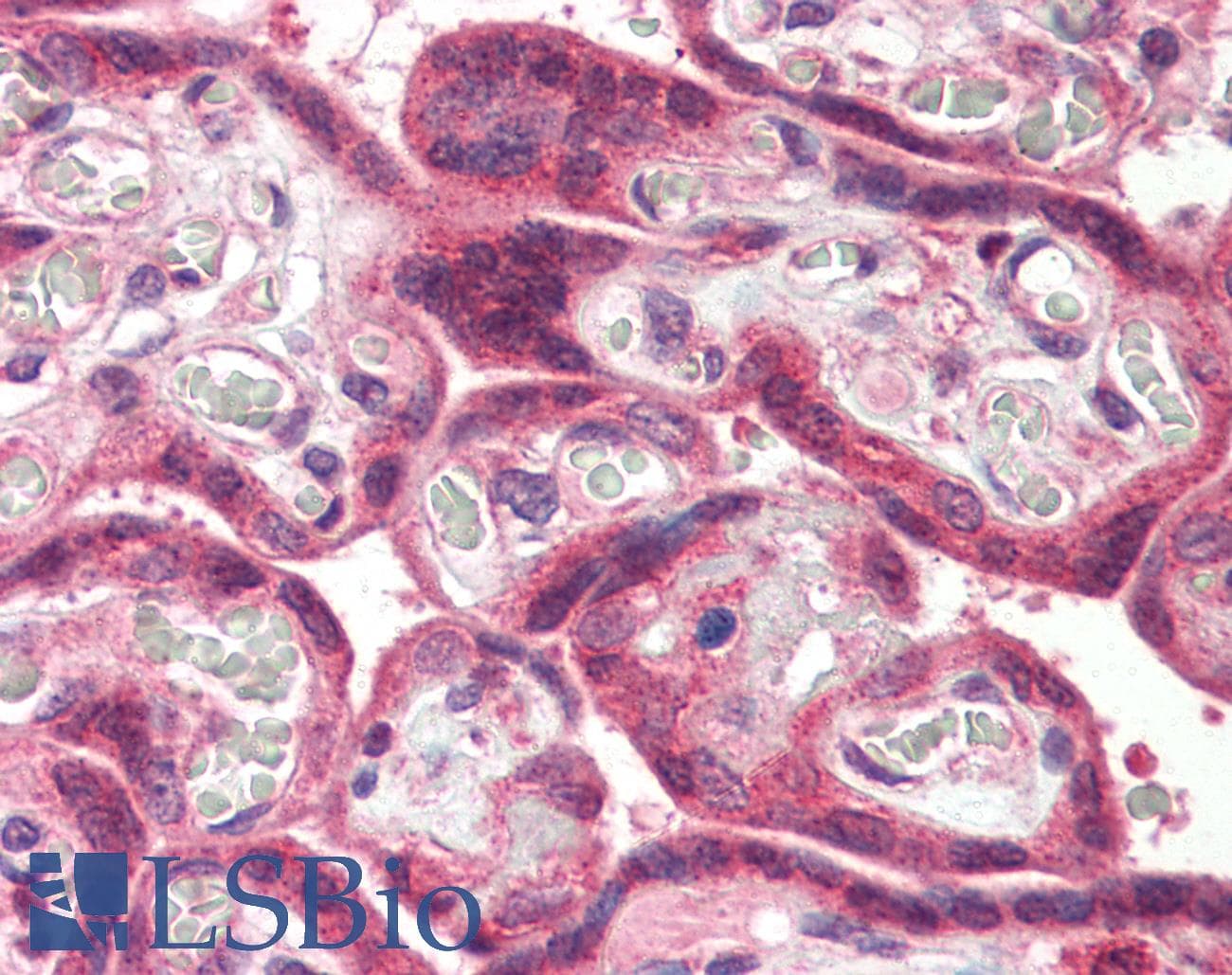 IHC-plus™ KIAA0152 / MLEC Antibody (Internal)