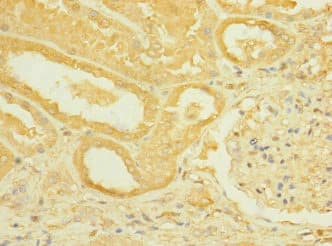 ROBO2 Antibody