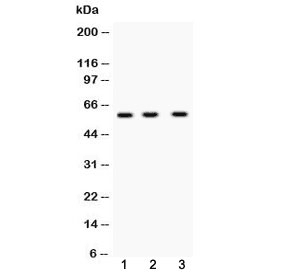 TNFRSF10B / Killer / DR5 Antibody