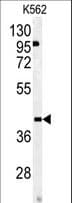 Polyclonal Rabbit anti-Human OMD / Osteomodulin Antibody (aa234-263, IHC, WB)
