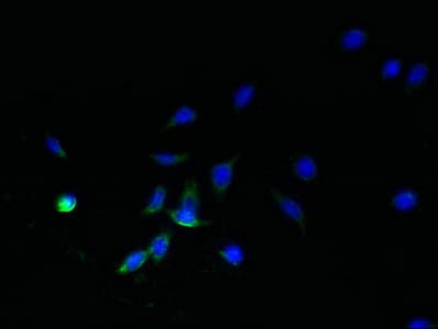 SDHC Antibody