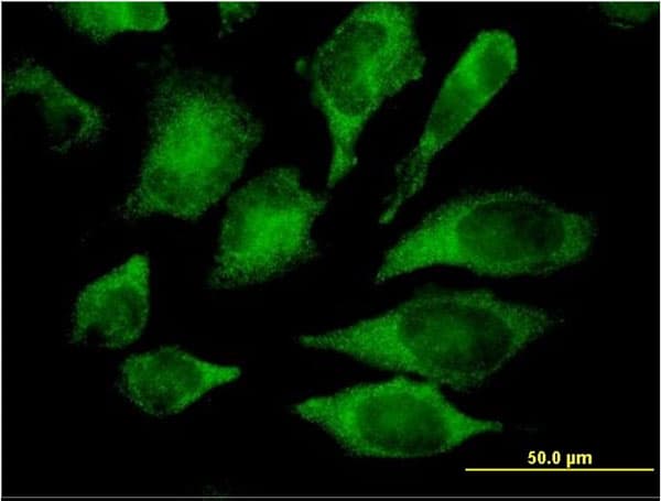 IHC-plus™ MAPK13 / p38delta Antibody (clone 1E11)