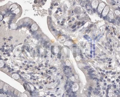 Polyclonal Rabbit anti-Human MMP7 / Matrilysin Antibody (IHC, IF, WB)