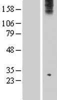 Human WDR75 Protein (Over-Expression Lysate Myc-DDK (Flag))