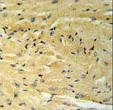 Polyclonal Rabbit anti-Human GNAT1 Antibody (aa290-318, IHC, WB)