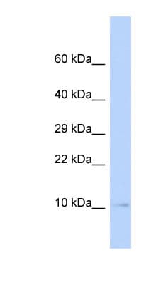 Polyclonal Rabbit anti-Human SUMO3 Antibody (C-Terminus, WB)