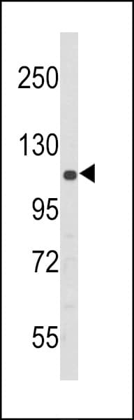 Polyclonal Rabbit anti-Human EIF2AK3 / PERK Antibody (aa148-175, IHC, WB)