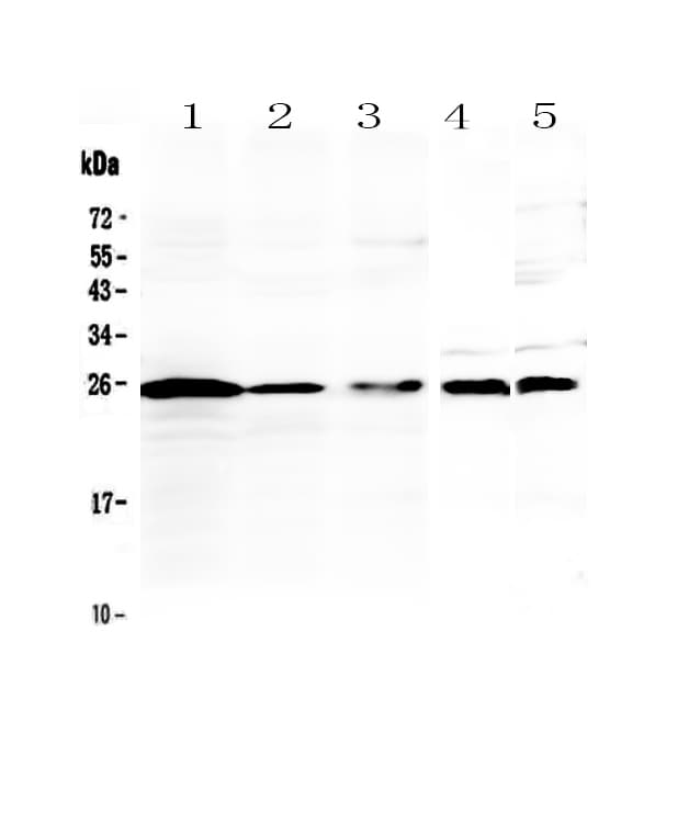 Polyclonal Rabbit anti-Human IL36A Antibody (WB)