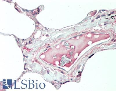 IHC-plus™ Polyclonal Rabbit anti-Human IL19 Antibody (aa39-52, IHC, WB)