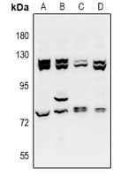 ATAC1 / ZZZ3 Antibody