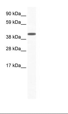 ZFP36L1 Antibody (aa66-115)