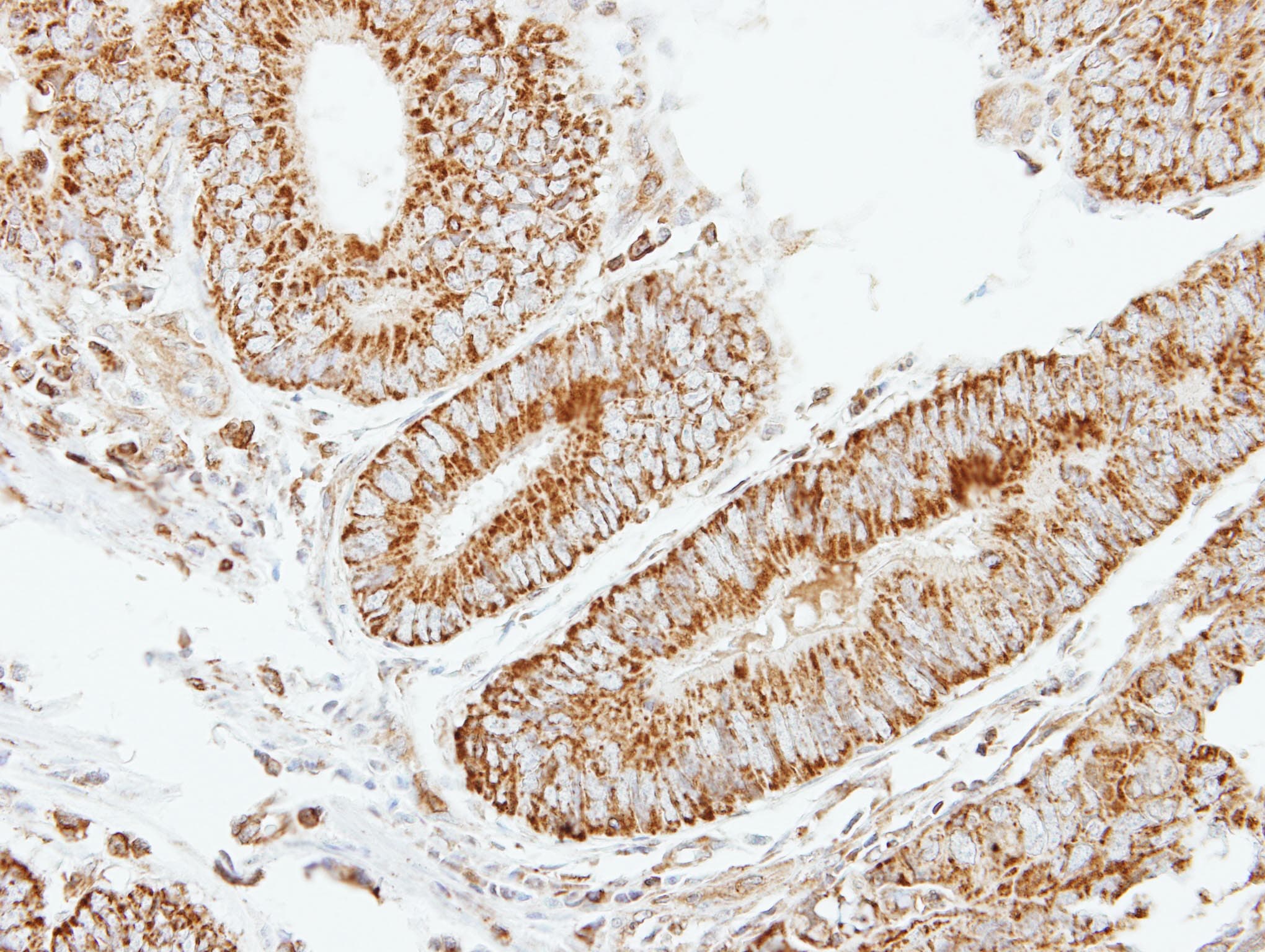 EIF2B2 Antibody (aa88-323)