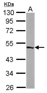 IHC-plus™ Polyclonal Rabbit anti-Human ENO3 / Enolase 3 Antibody (aa196-434, IHC, WB)