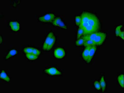 Polyclonal Rabbit anti-Human FAT10 / UBD Antibody (aa1-165)